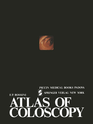 cover image of Atlas of coloscopy